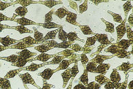 Phragmotrichum chailletii Sporen