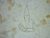 Gymnosporangium clavariiforme-Teliospore Foto Thomas Kalveram