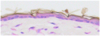 normalskin