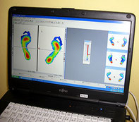 足圧分布測定器