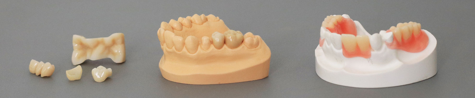 Zahnersatz Dr Hornung Zahnmedizin Oralchirurgie Implantologie Ihr Partner In Gerolzhofen Bei Schweinfurt