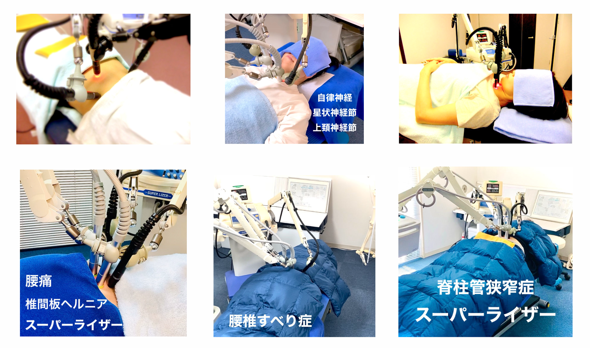 近赤外線　電子灸　星状神経にも 近赤外線機器「スーパーライザー」について | 美容鍼・不妊治療