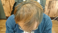 薄毛克服体験記ブログ6月24日の店長の頭頂部写真