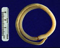 ascaris
