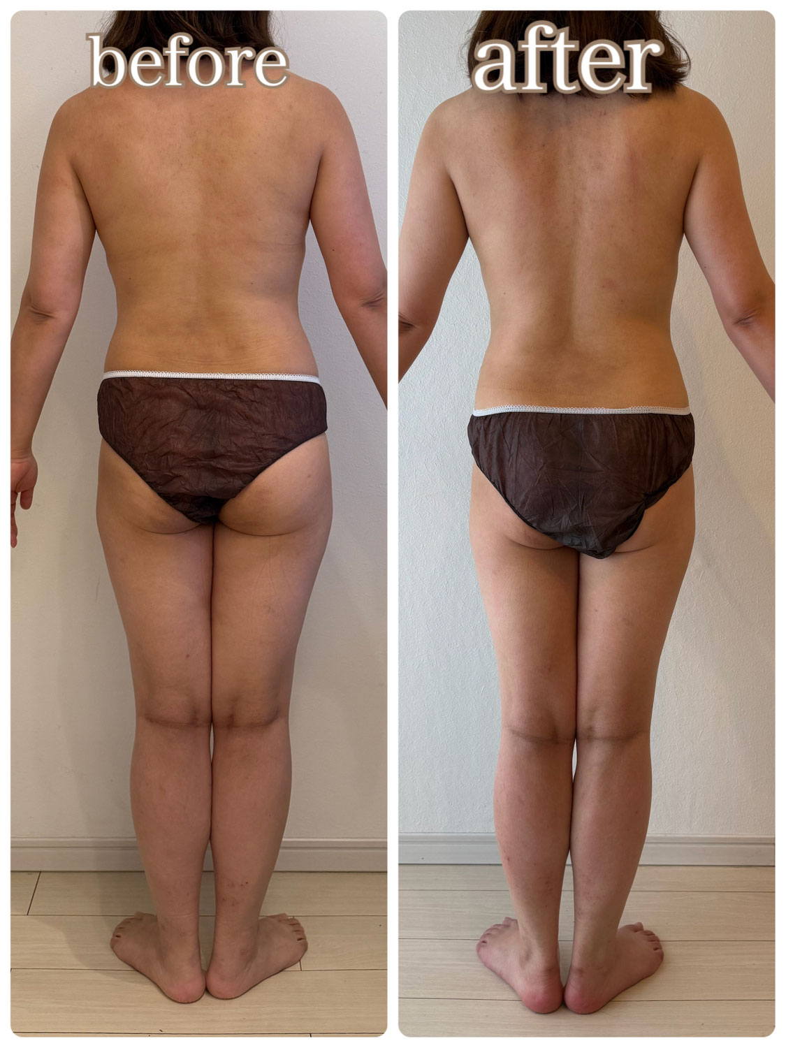 【お客様の変化】脱！オバチャンシルエット