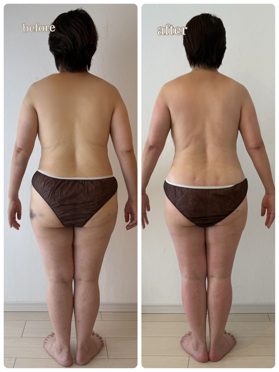 【お客様の変化】3ヶ月−6.1kg 中年太りから抜け出せました！