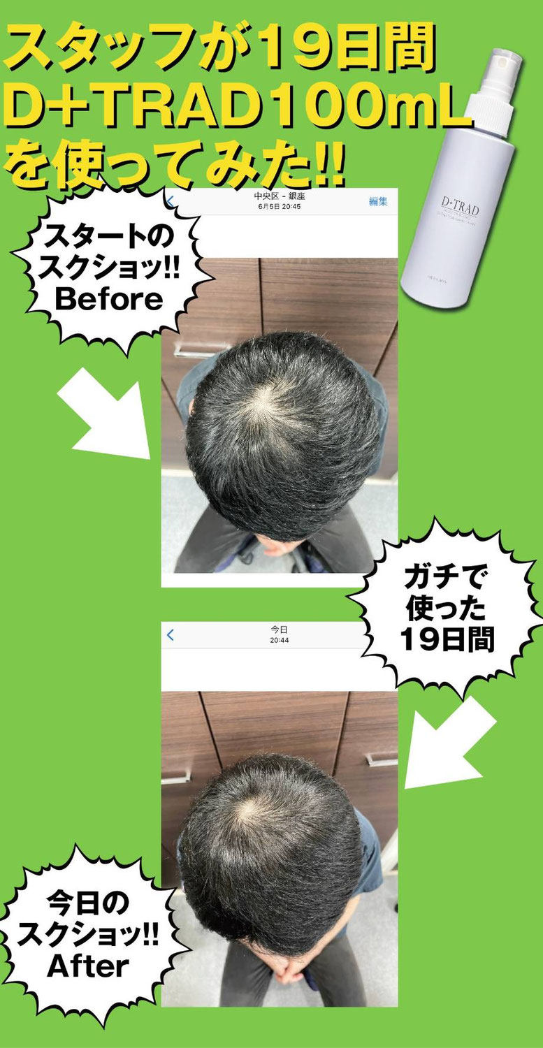 D+TRADエッセンス100mlをSTAFFが19日間使用してみた！  （Gottcha）