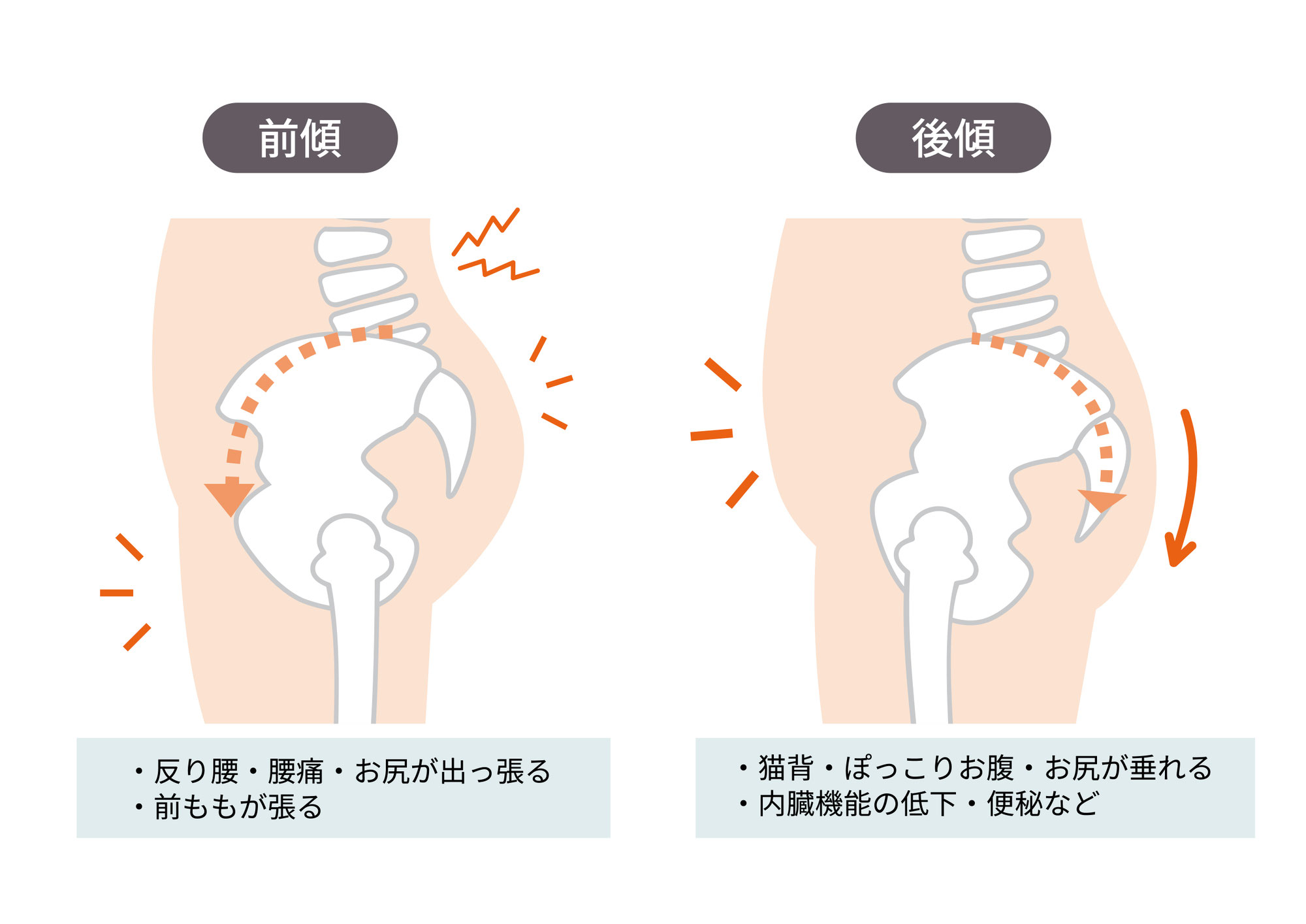 腰痛予防・脂肪燃焼！股関節を鍛える重要性。