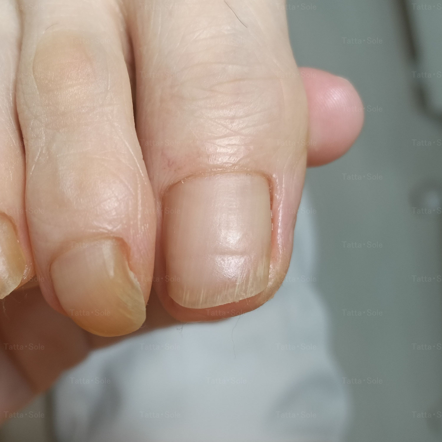 爪が縦に割れた！ネイルはお休みしてケアに専念します　その③