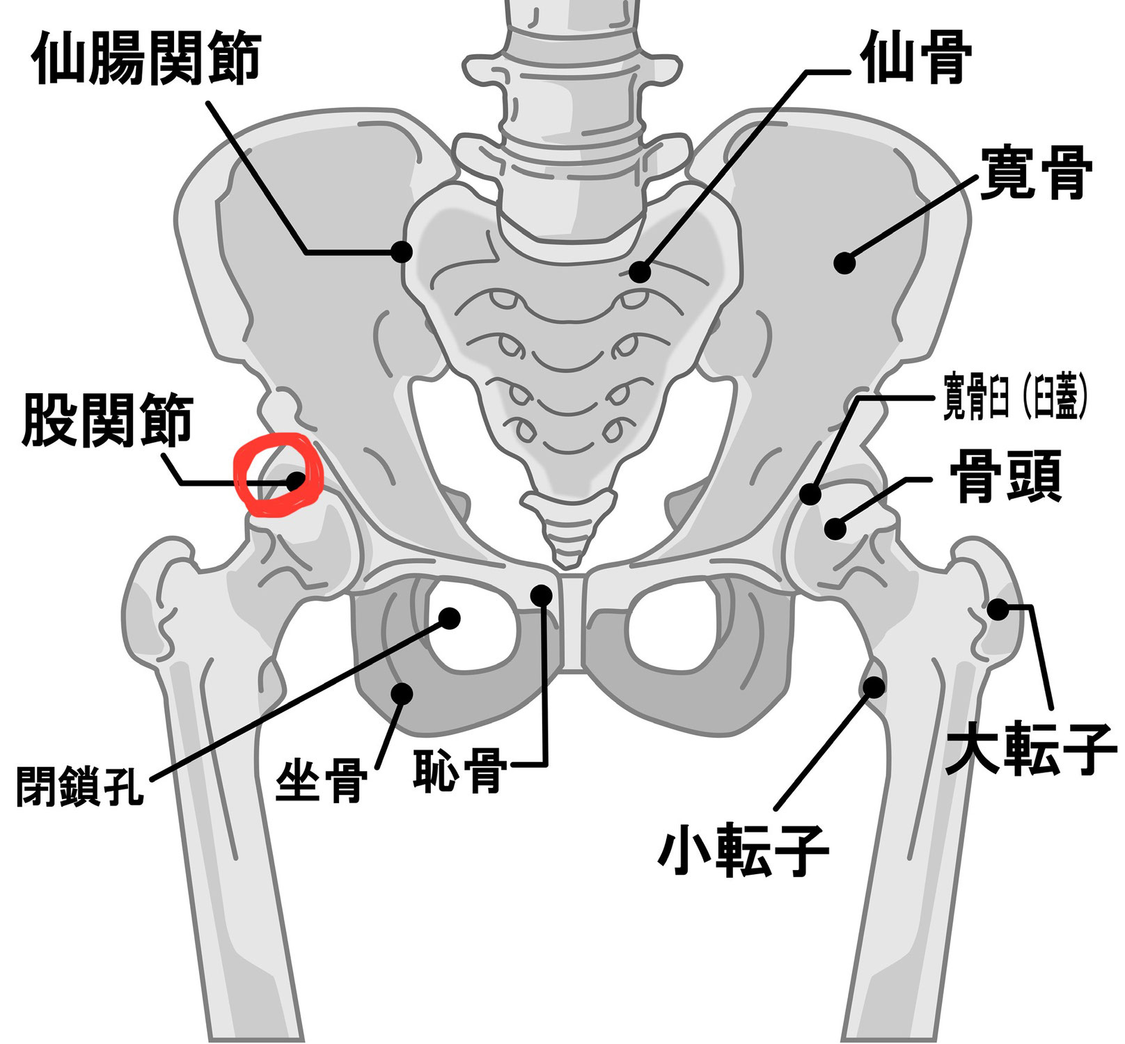 【臼蓋形成不全】な股関節