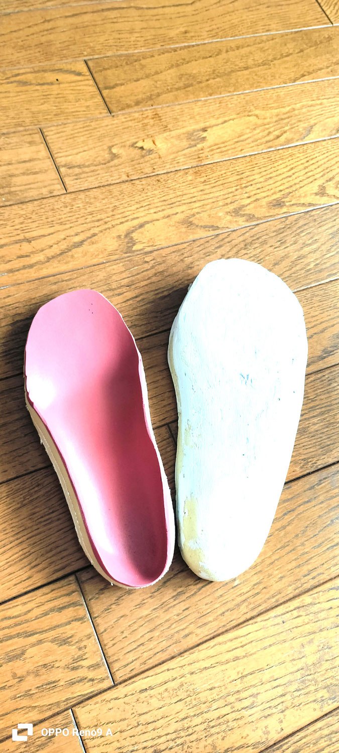 関節リウマチの痛みを軽減するインソール