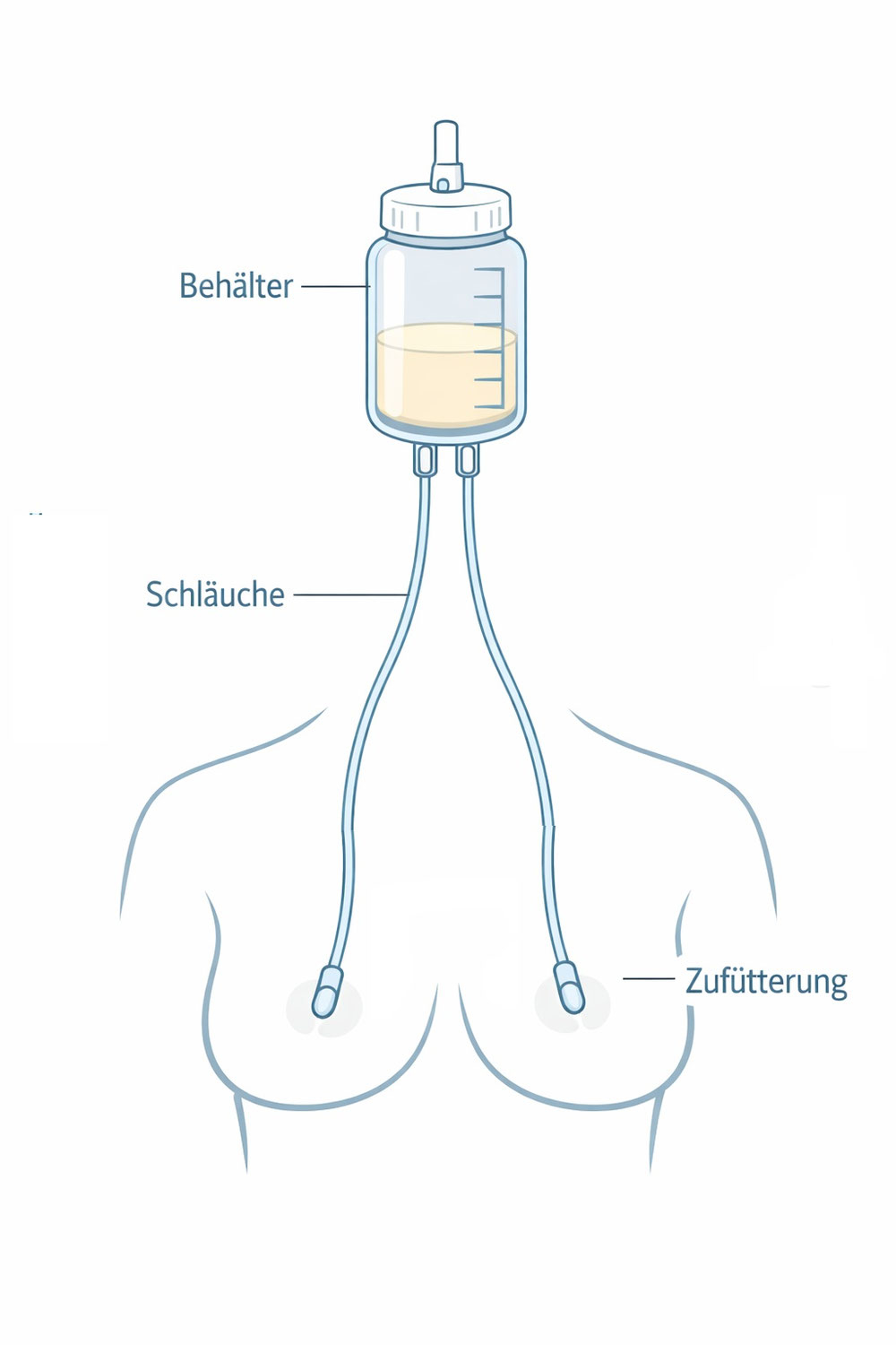 Brusternährungsset (BES / SNS): Stillen und Zufüttern gleichzeitig – evidenzbasiert erklärt