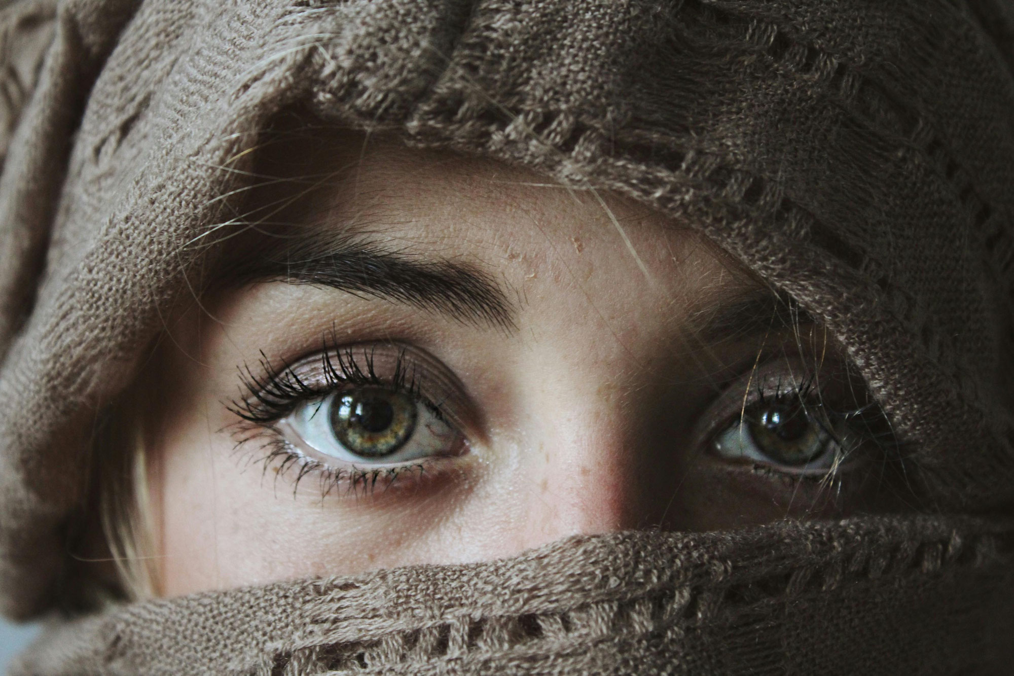 Yeux Cernés : Quelles Sont Les Causes Et Comment Y Remédier