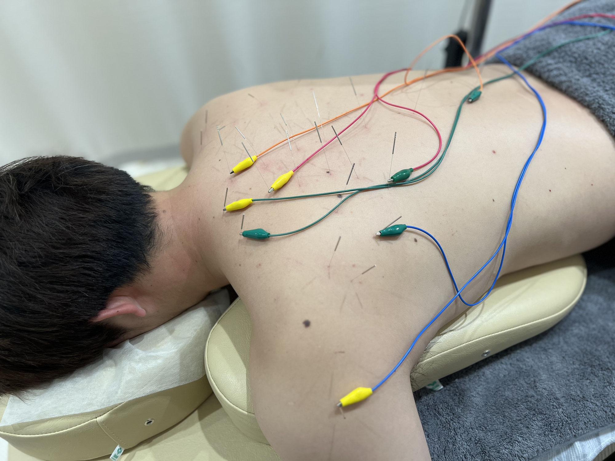 ゴルフ初心者に多いスイングショルダー（ゴルフ肩）