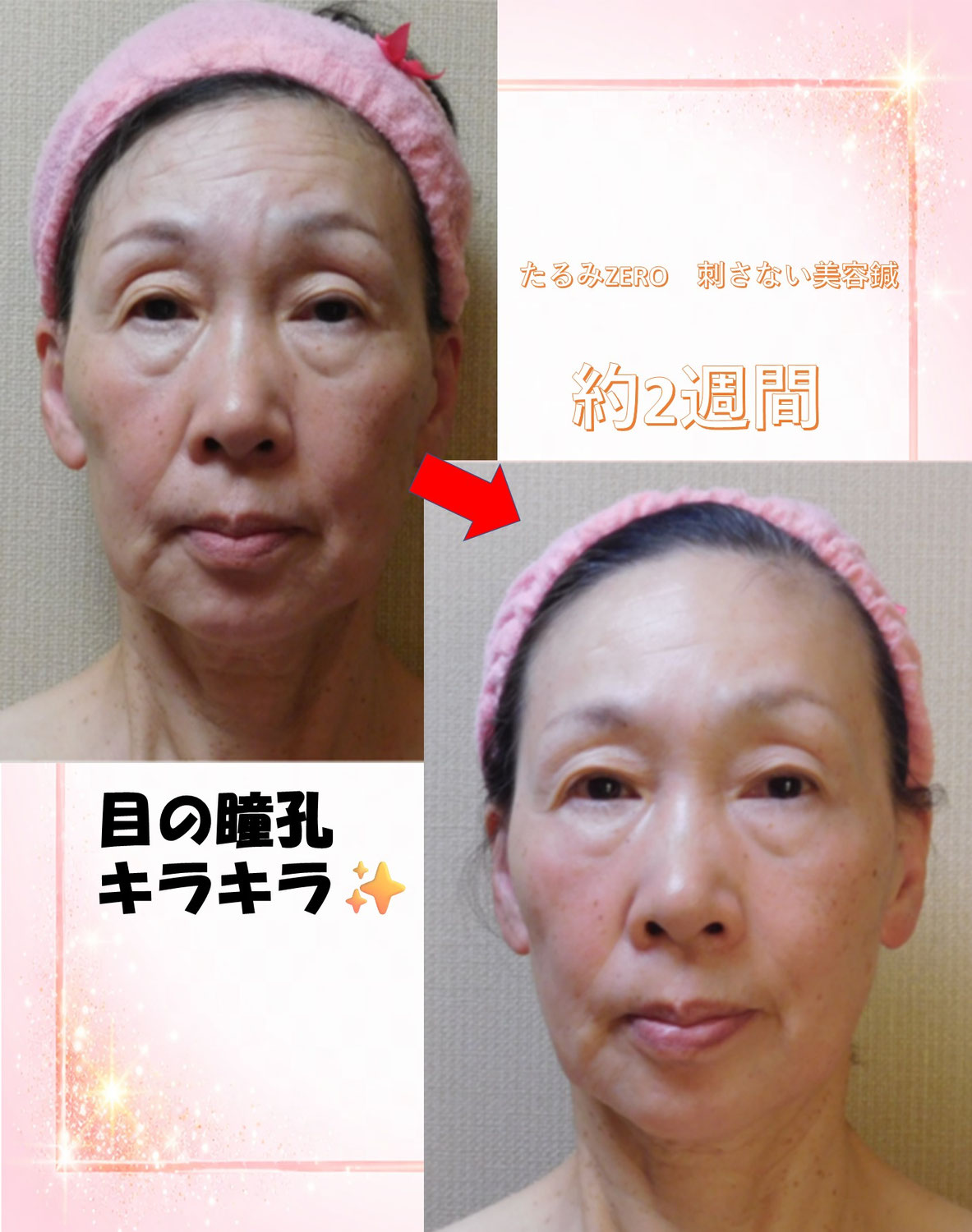 お子様の結婚式前に速攻で変わりたい