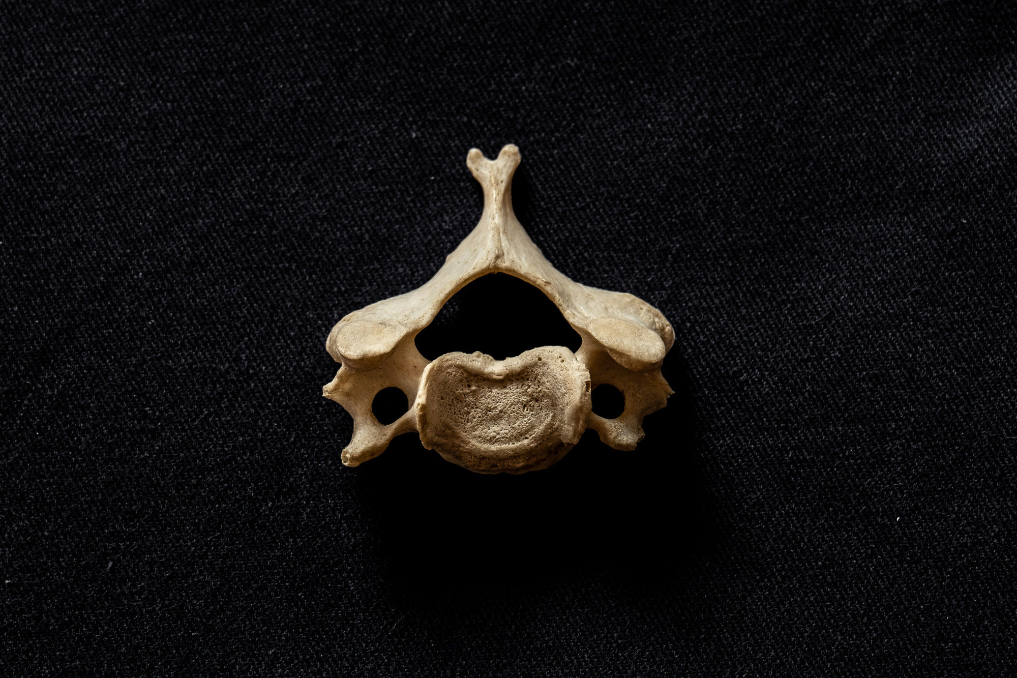 Die Halswirbelsäule aus osteopathischer Sicht - von Daniel Randzio