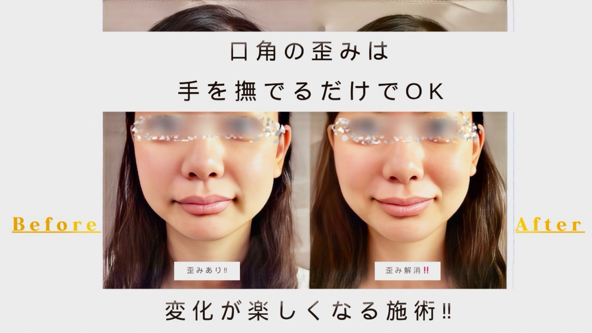 顔の歪み矯正｜あおぞら整体院