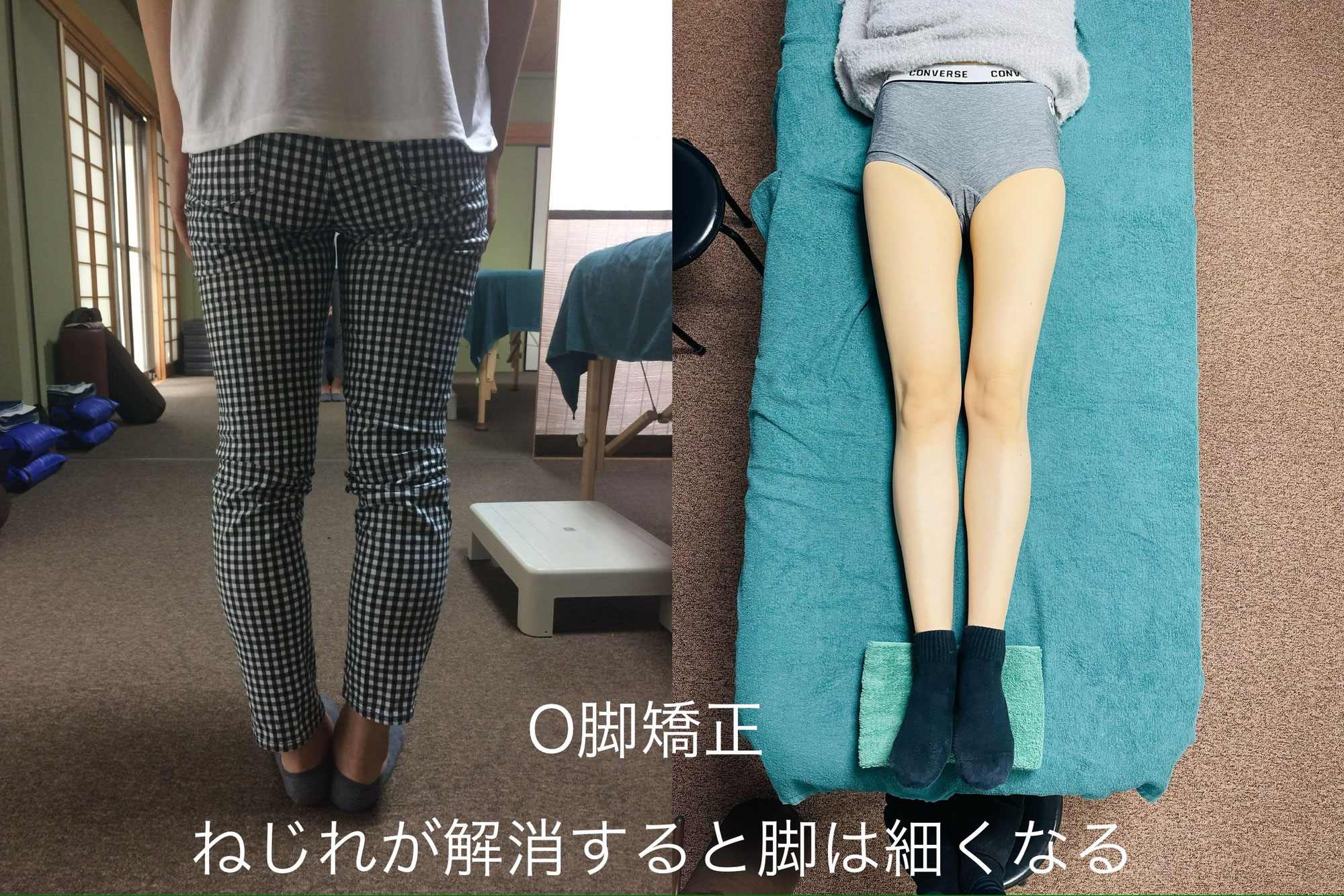 戻らないＯ脚矯正の秘密｜あおぞら整体院