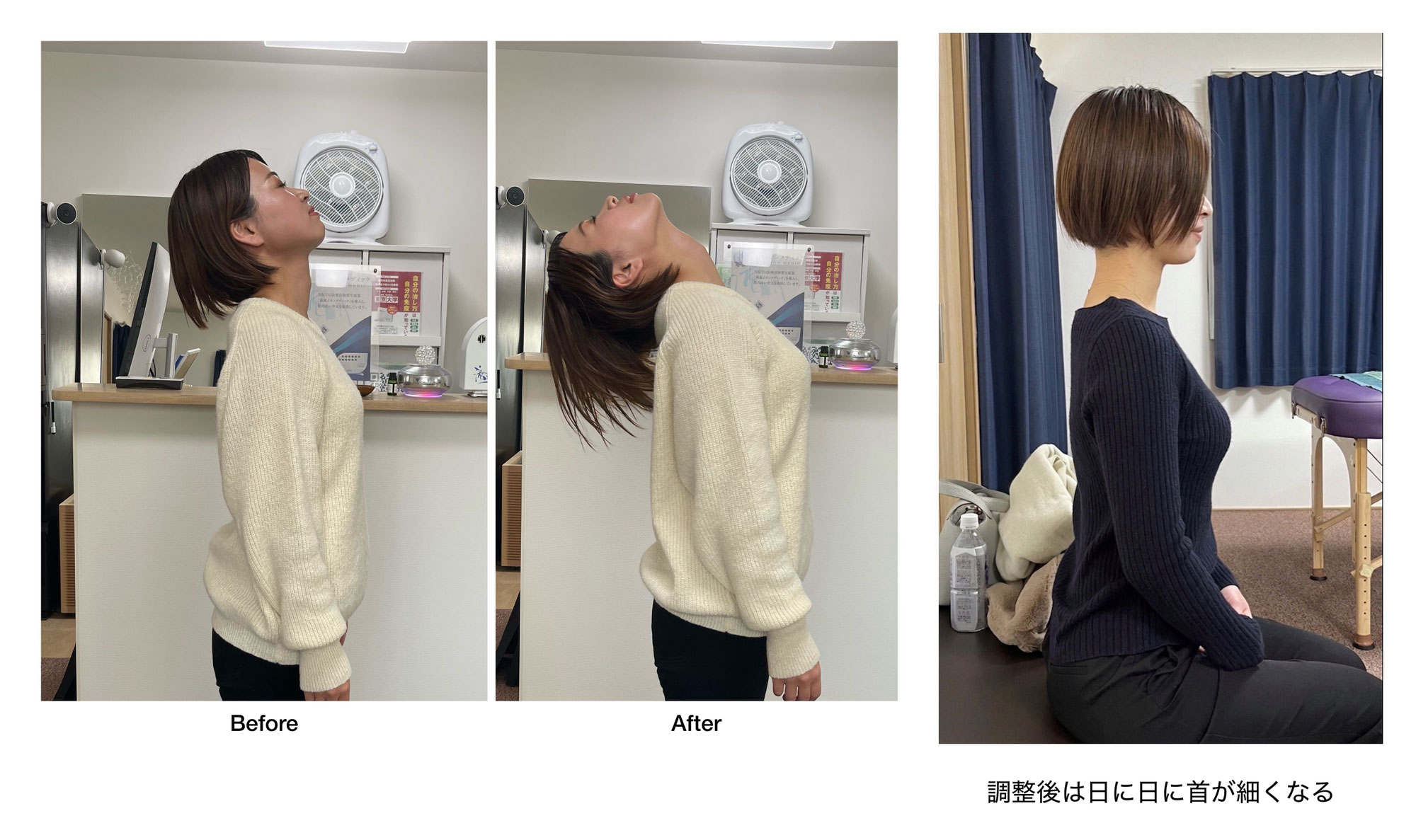 上を向くと首が詰まる原因とは？姿勢・肩こり・小顔に関係する頭の位置の秘密