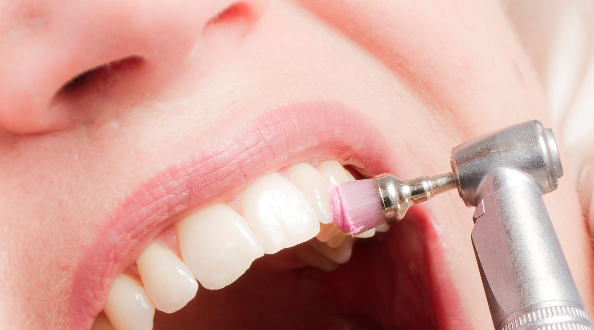 Prophylaxe: - Ihr Zahnarzt Wiesenbach