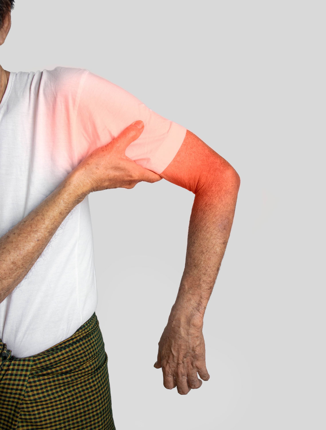 Transcatheter Arterial Embolisation (TAE) als Behandlungsoption für Adhesive Capsulitis: Ein Überblick