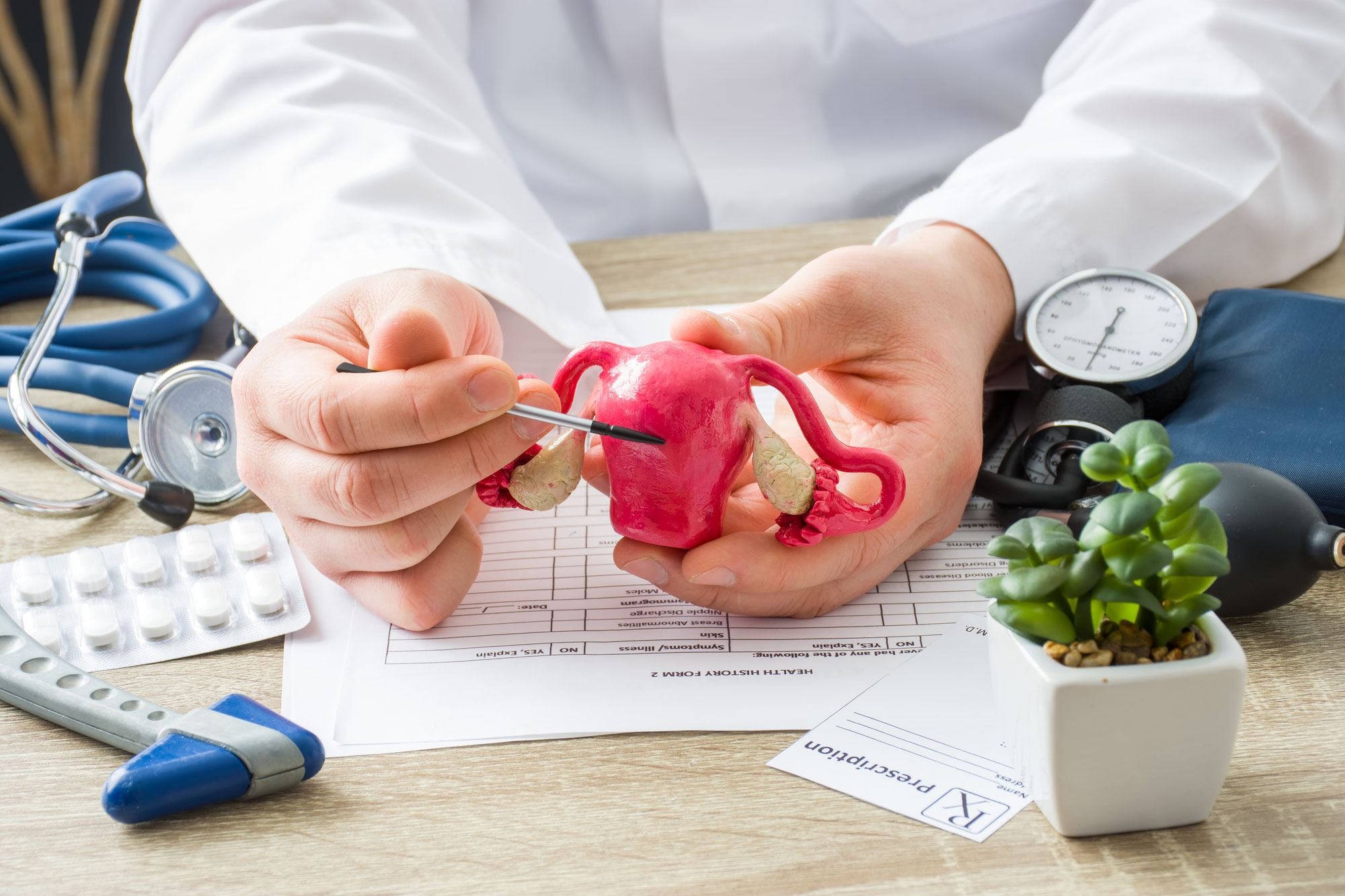 Myomembolisation: Eine effektive Methode zur Behandlung von Uterusmyomen