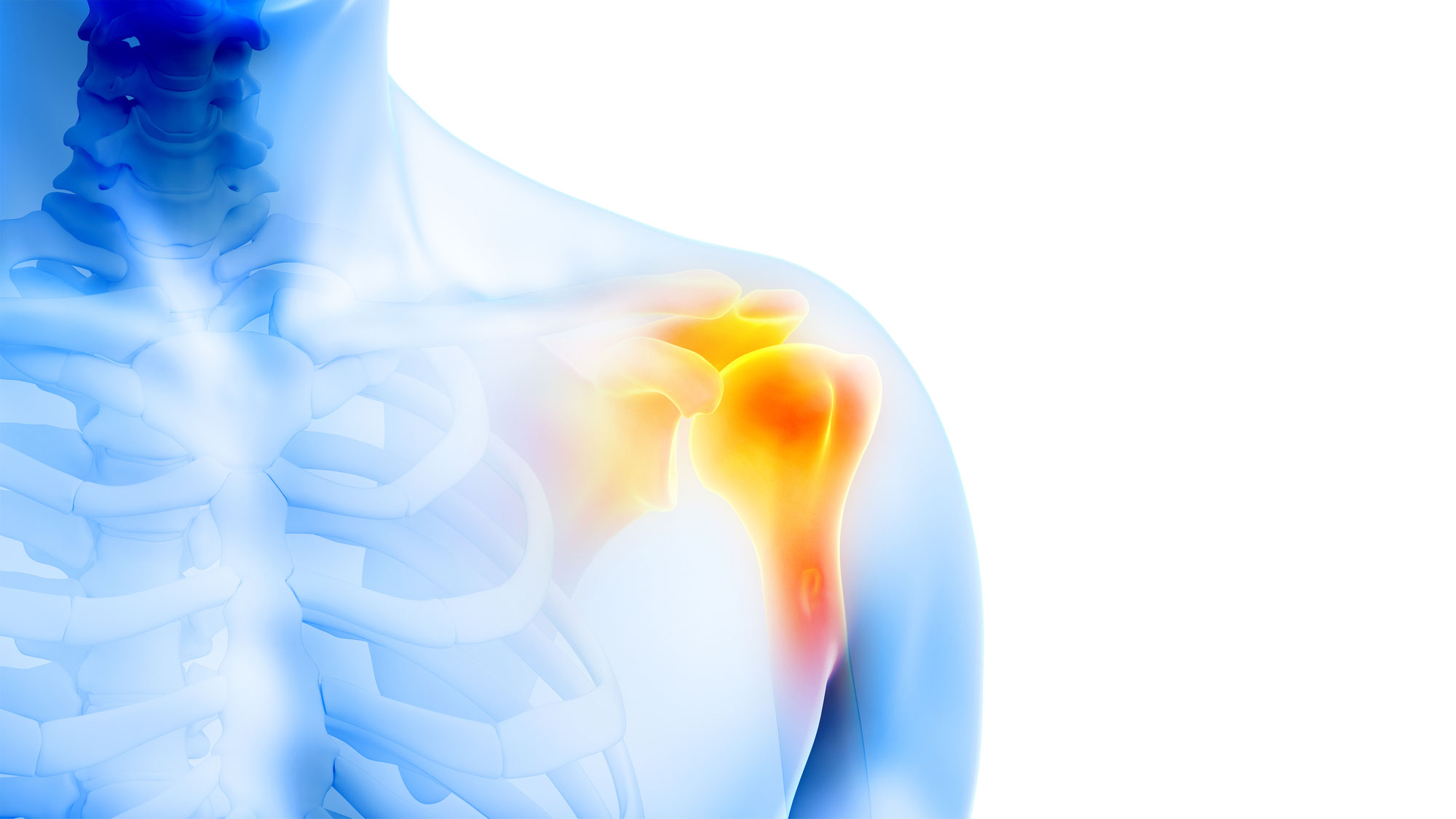 Neuer Beitrag auf ARD: Transarterielle Embolisation als innovative Therapieoption bei Gelenkschmerzen