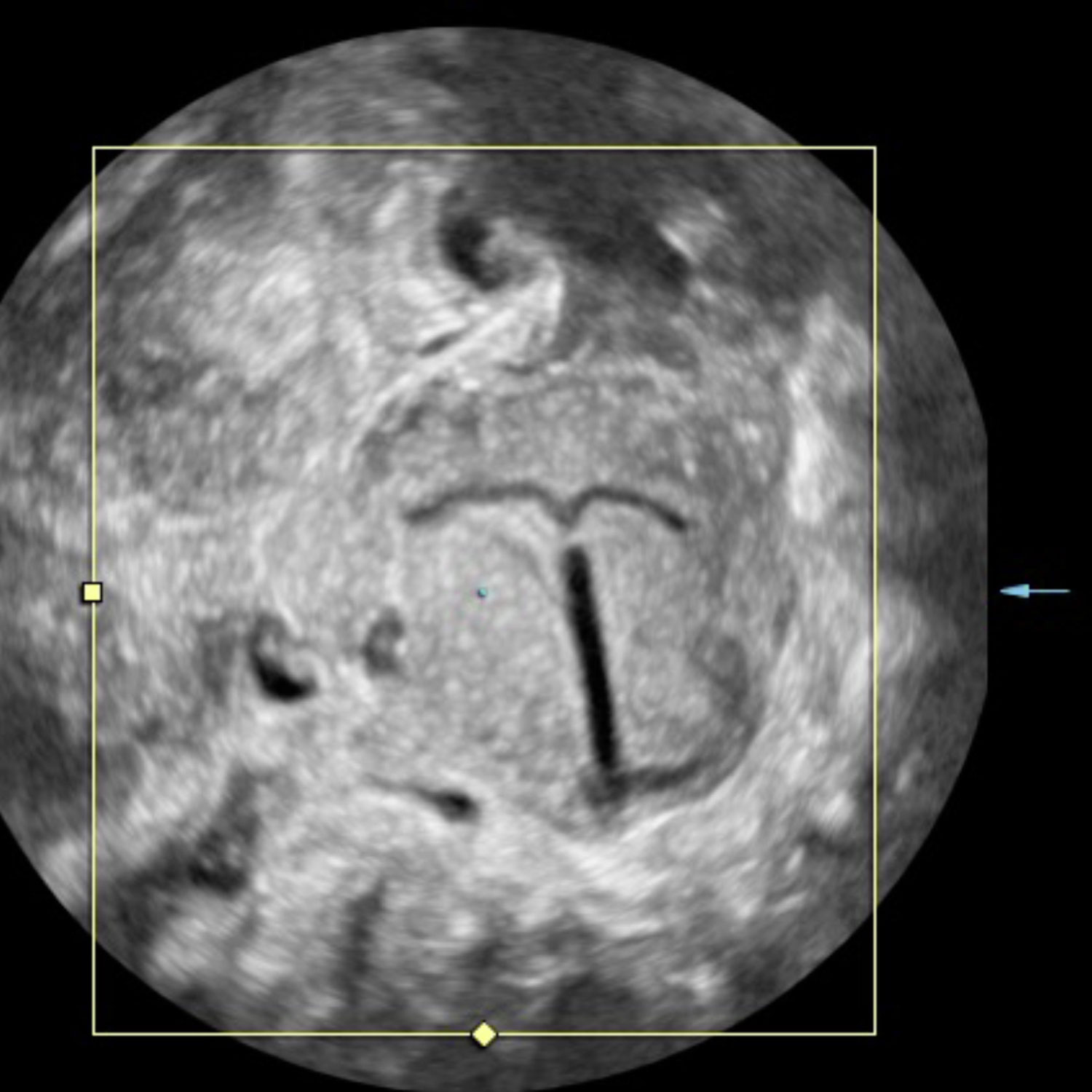 Fortbildung: »AI in der Ultraschalldiagnostik« und »3D-Ultraschall in der Gynäkologie«