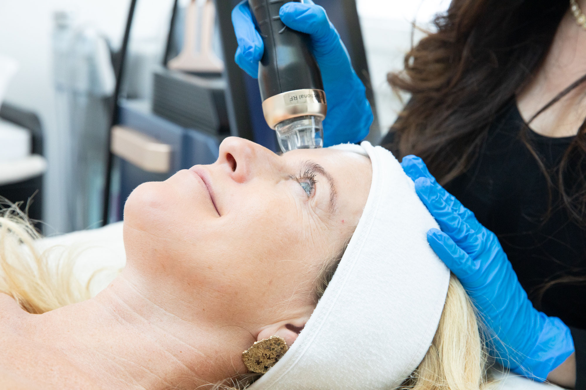Anti Aging / RF Microneedling Aktion