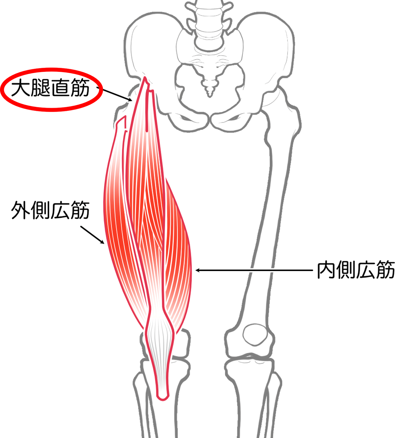 下前腸骨棘炎（大腿直筋付着部炎）