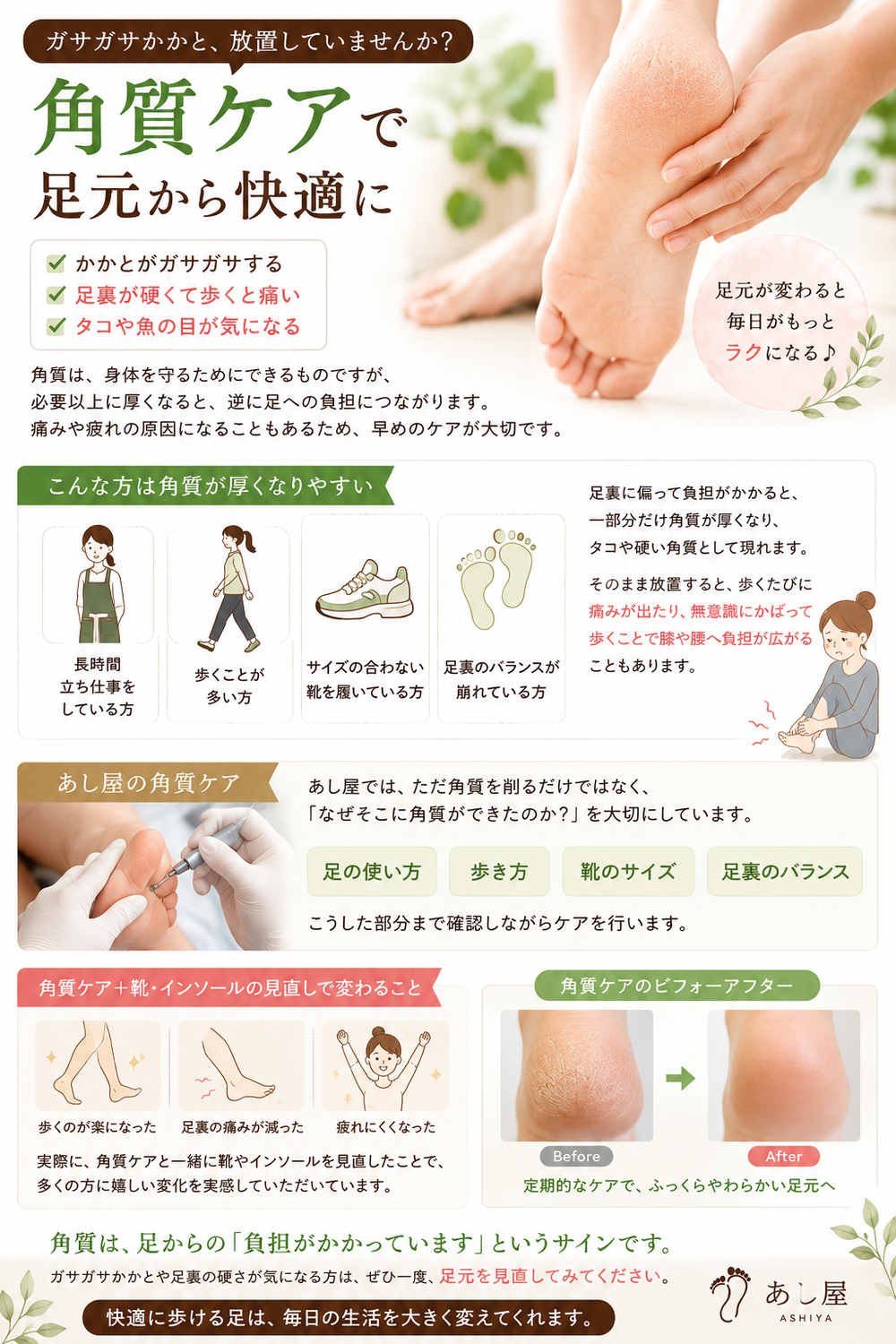 ガサガサかかと、放置していませんか？｜角質ケアで足元から快適に