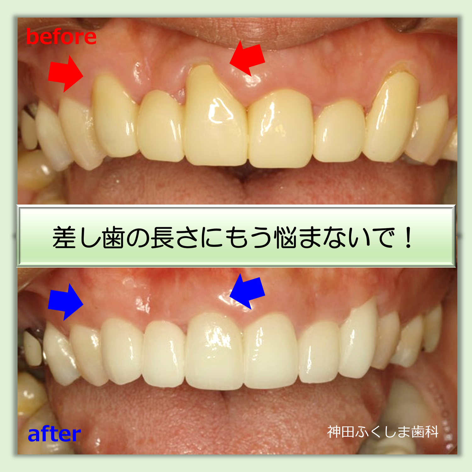 審美歯科ブログ　費用を抑えて提供している理由