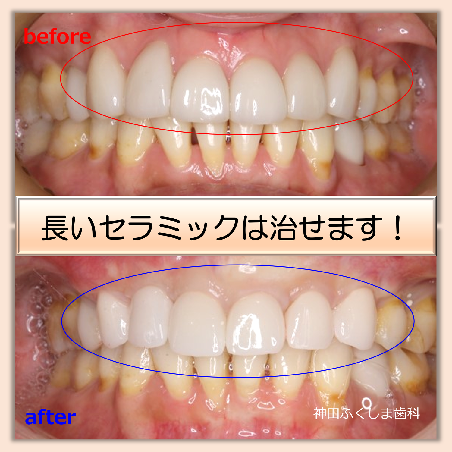 審美歯科で確認したほうが良いよくあるご質問.
