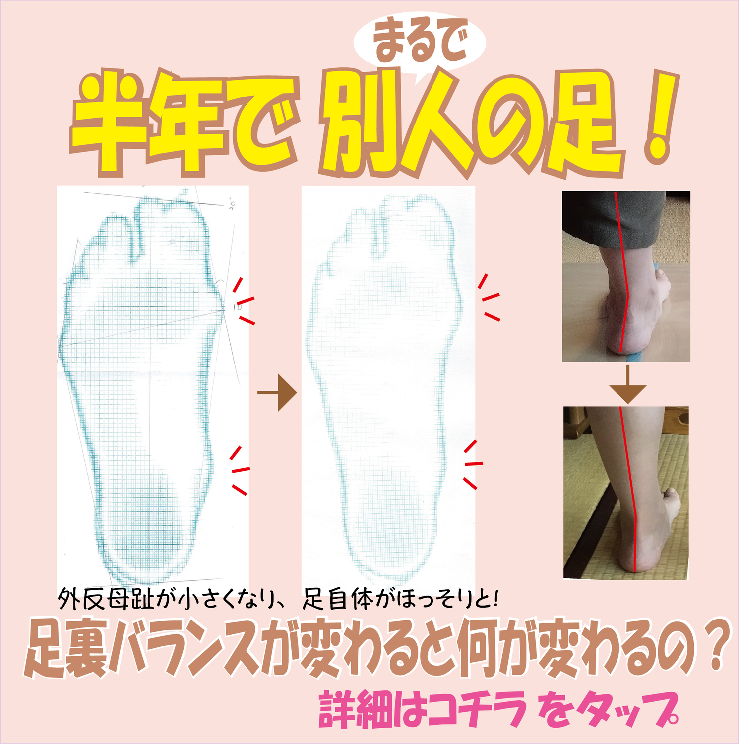 半年でまるで別人の足！足裏バランスが変わると何が変わるの？
