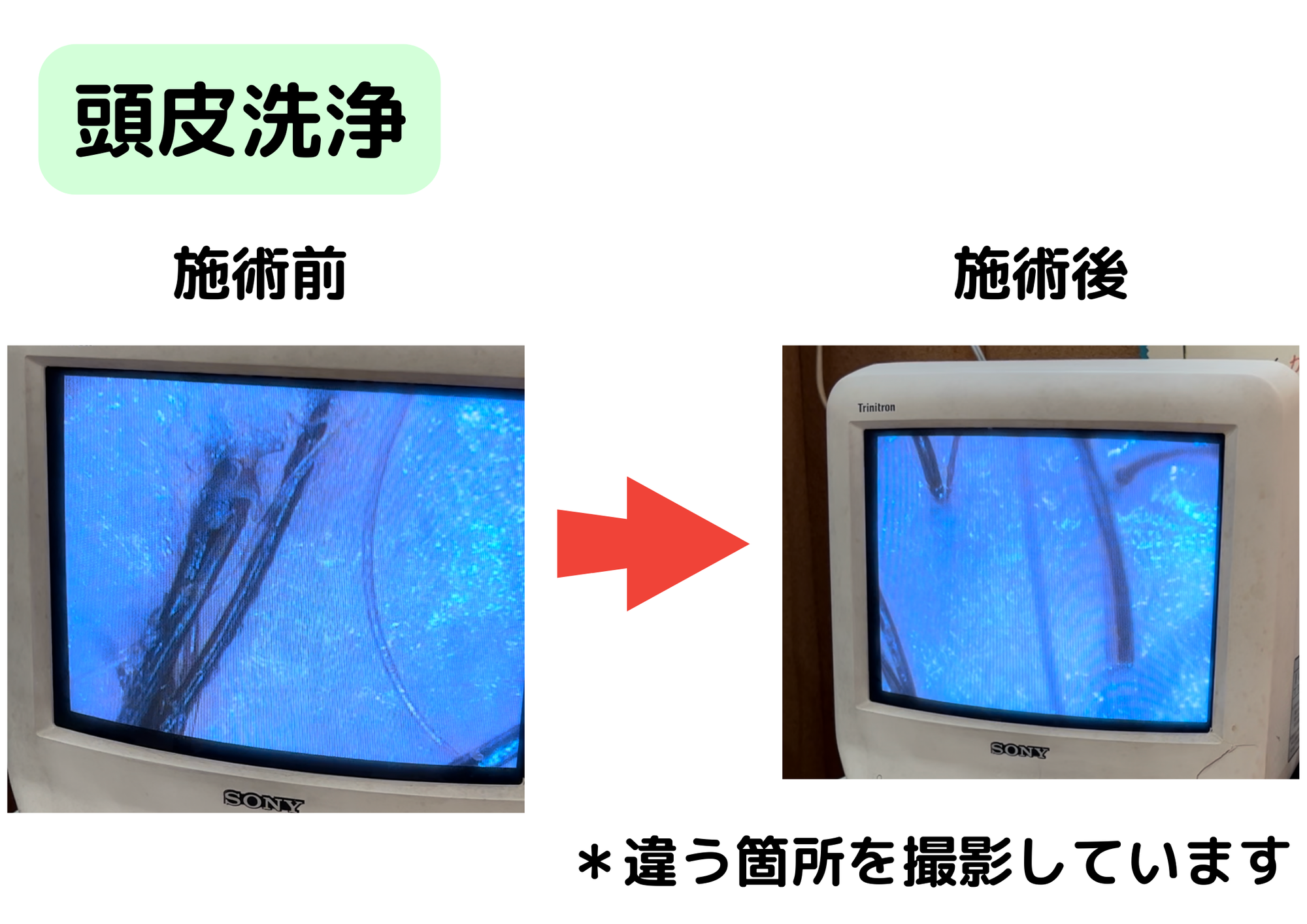 本日のお客様　〜頭皮洗浄　20代　男性〜