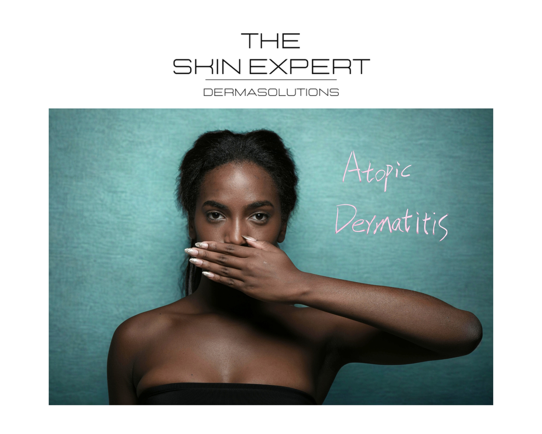 Periorale Dermatitis: Wat Het Is en Hoe We Het Behandelen bij The Skin Expert
