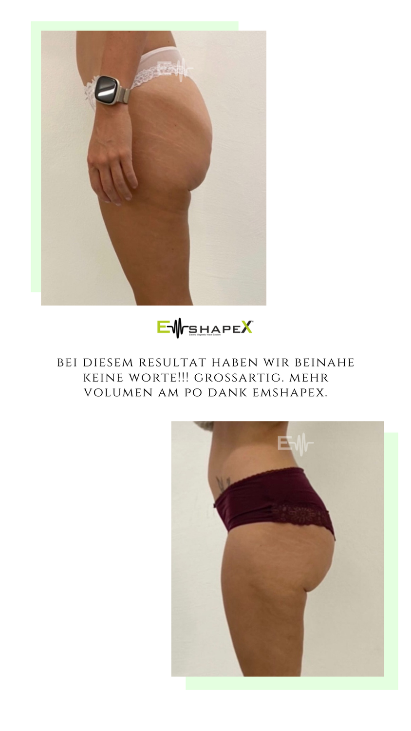 Bodyforming Emshape Angebot