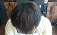  薄毛克服体験記ブログ8月18日の店長の頭頂部写真