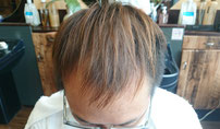  薄毛克服体験記ブログ6月15日の店長の頭頂部写真