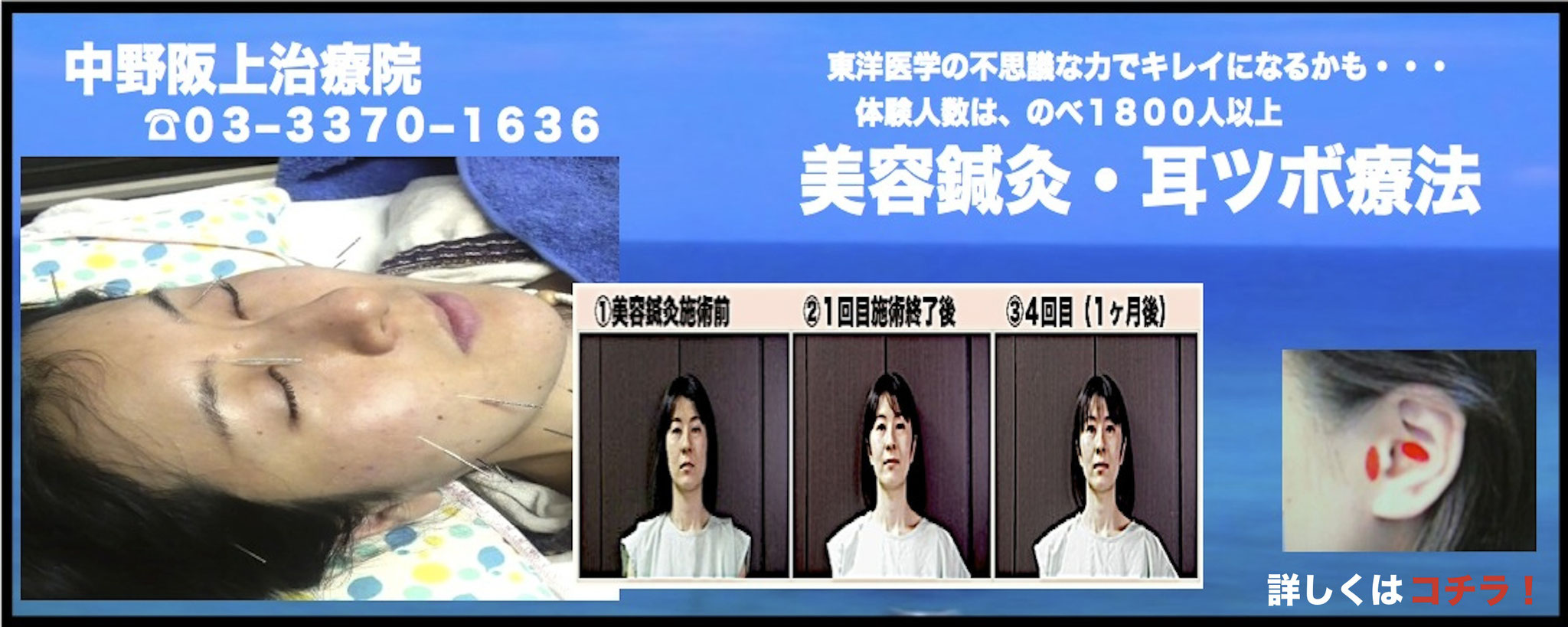 中野坂上の整体 駅から1分 中野坂上治療院 中野坂上の整体 美容鍼といえば駅から1分 中野坂上治療院 中野坂上の整体 駅から1分 中野坂上治療院 中野坂上の整体 美容鍼といえば駅から1分 中野坂上治療院