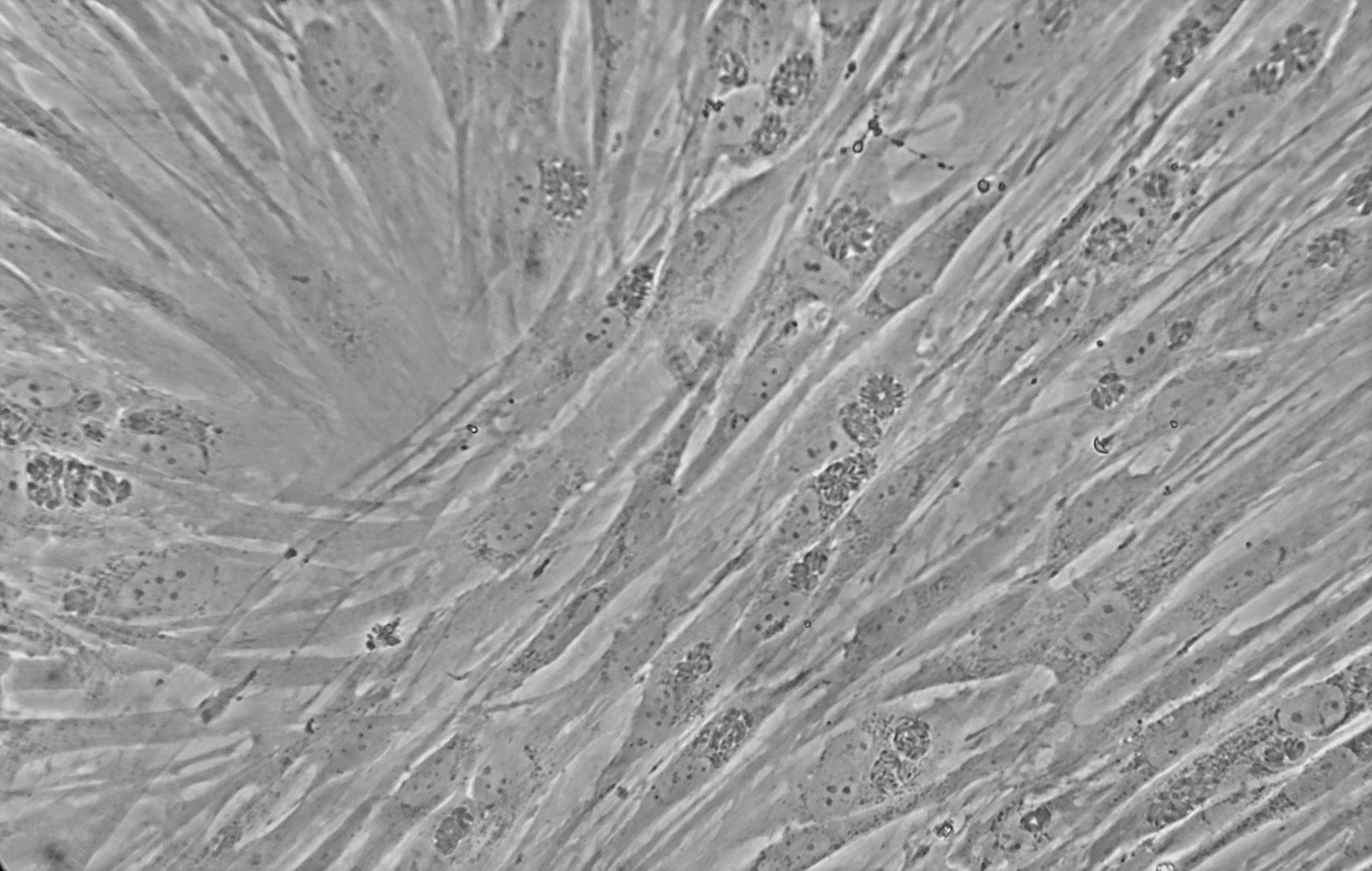 Formation of rosettes within vacuole in the Toxoplasma gondii infected cells. Photo credits to Athena