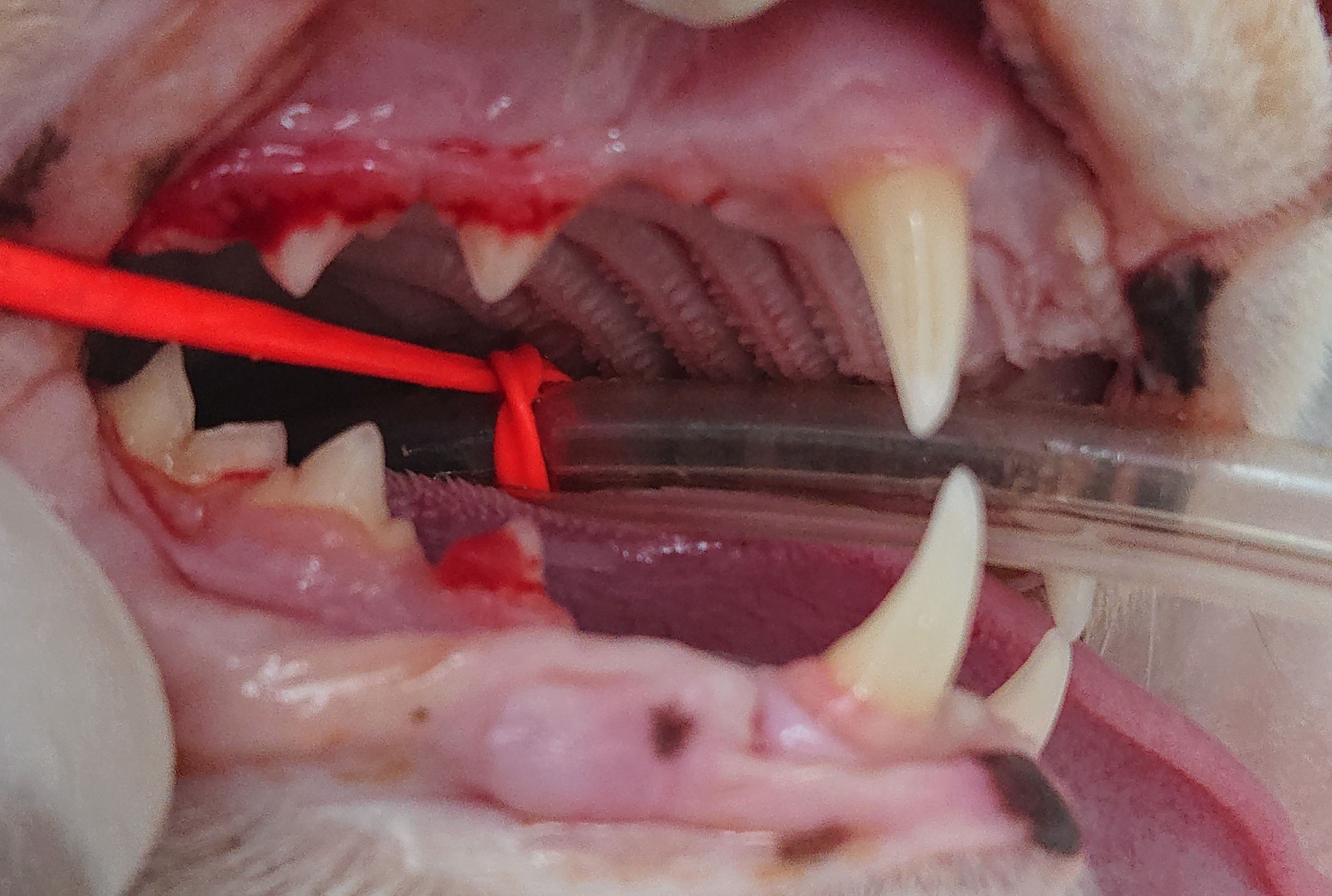 右下第一前臼歯に赤い歯肉の盛り上がりあり