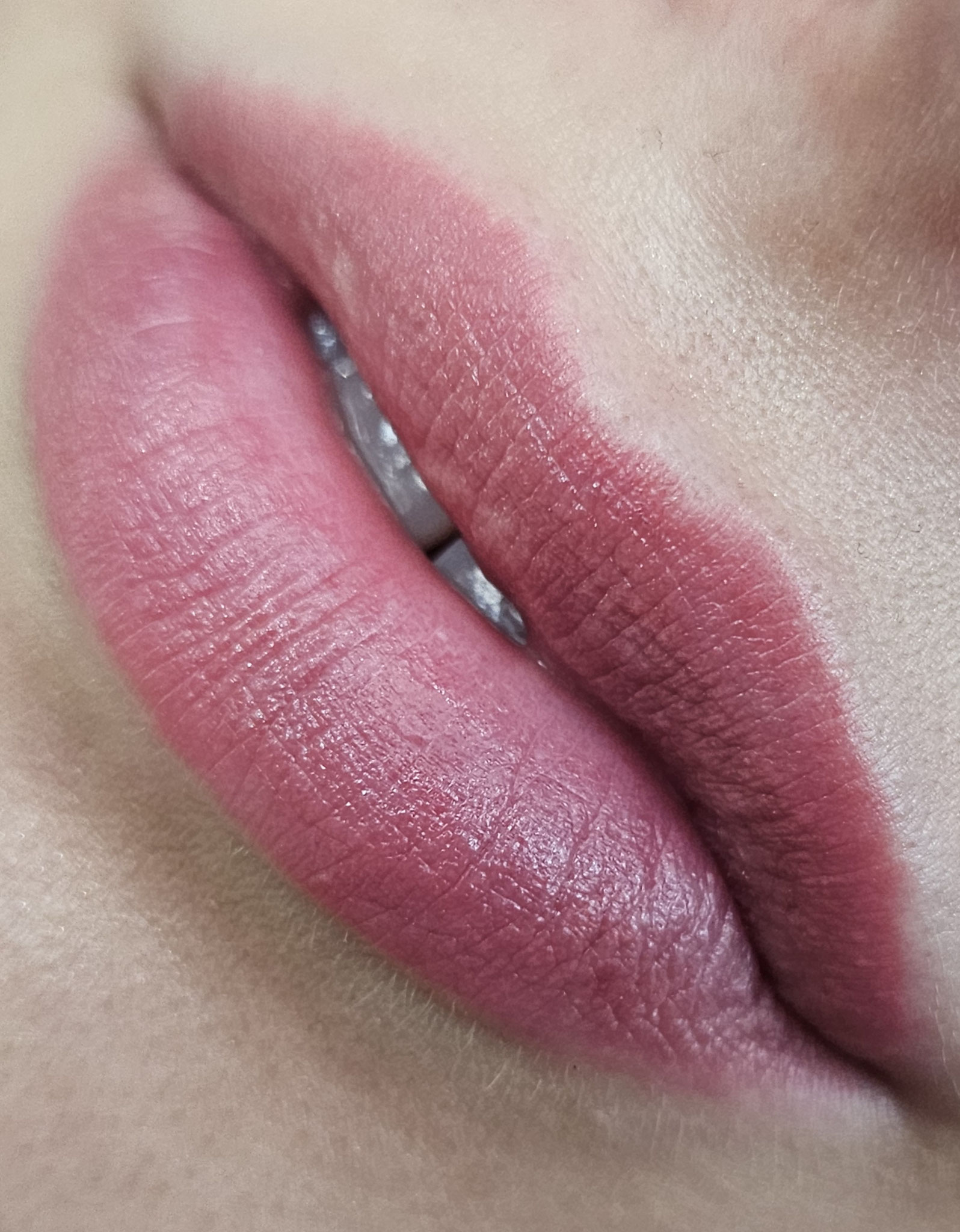 Soft Lip Blush - natürliches Ergebnis abgeheilt