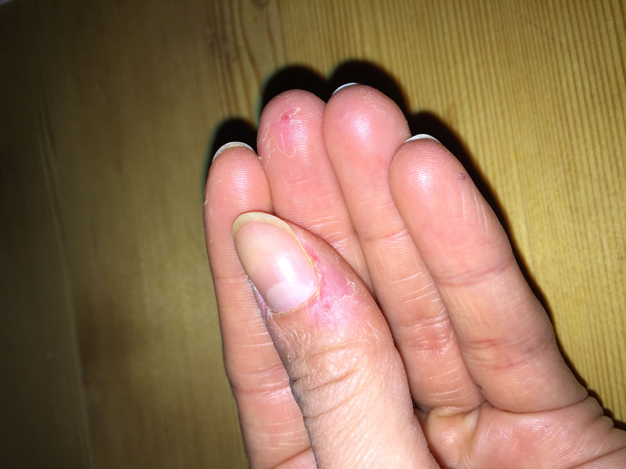 fotos - skin-picking.de