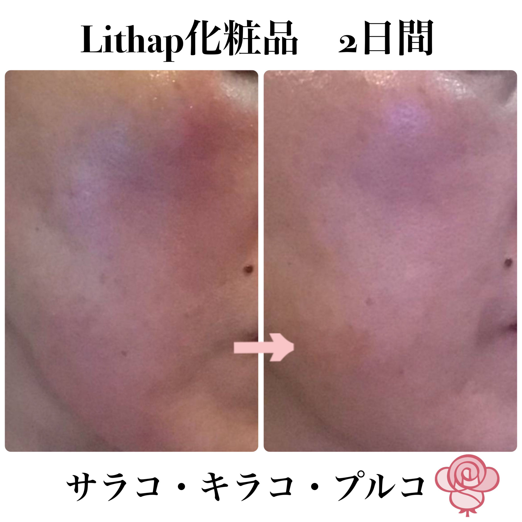 サロン専売Lithap化粧品お取扱いサロン様募集 - Lithap-リトハピ- サロン専売Lithap化粧品お取扱いサロン様募集 - Lithap-リトハピ-