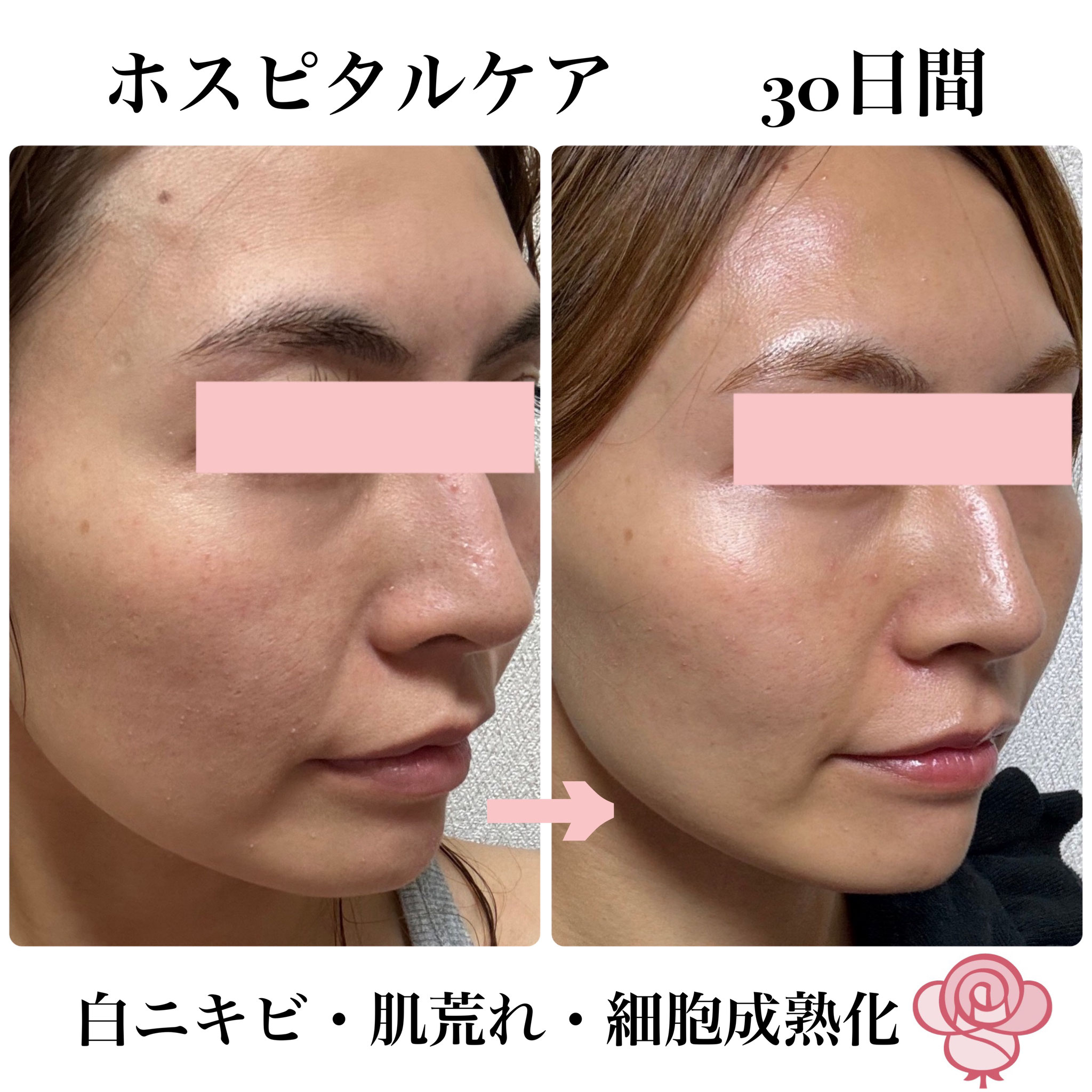 サロン専売Lithap化粧品お取扱いサロン様募集 - Lithap-リトハピ-