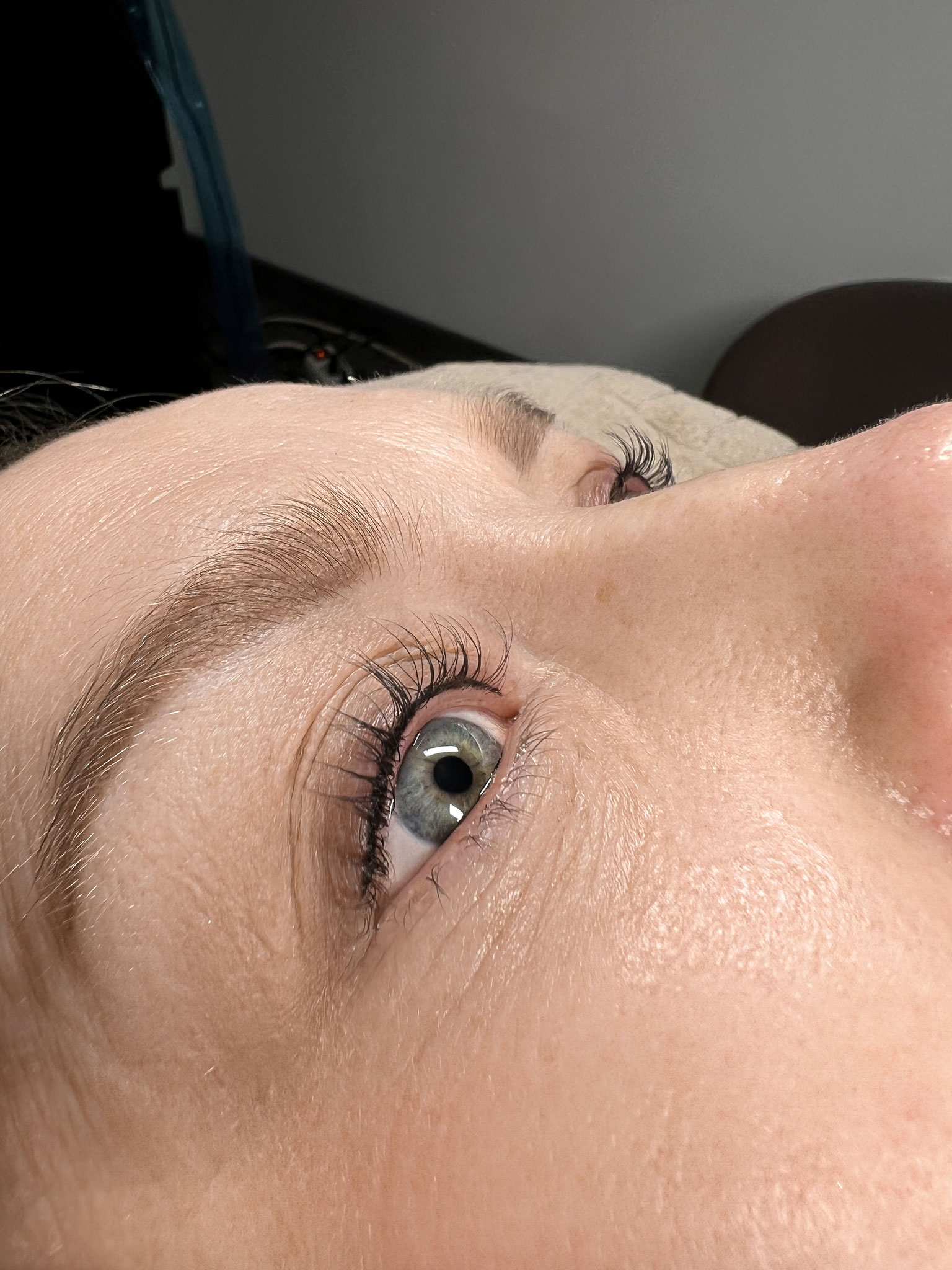 Wimpernkranzverdichtung