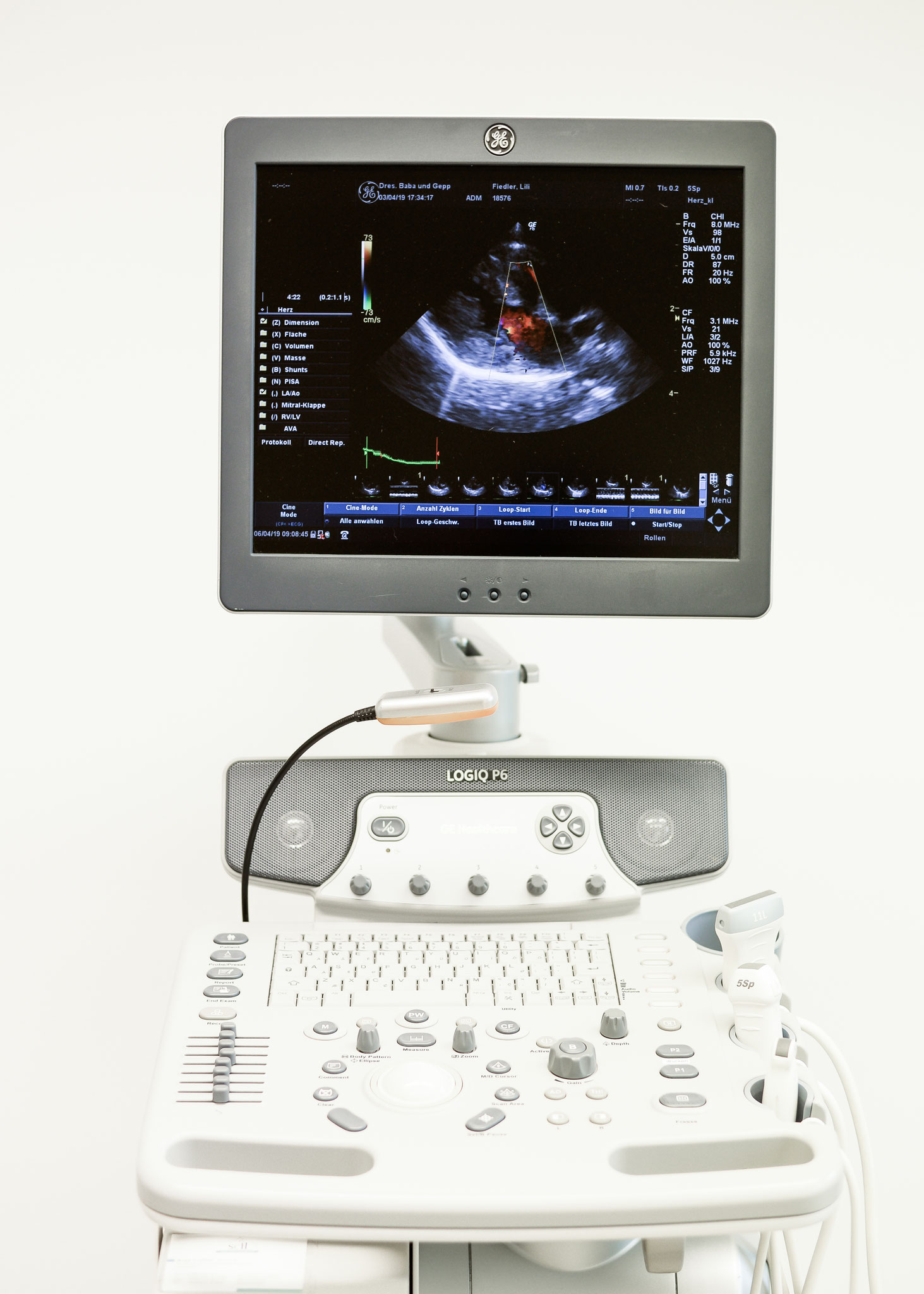 HighEnd Ultraschall mit Doppler auch für die komplette Kardiologie