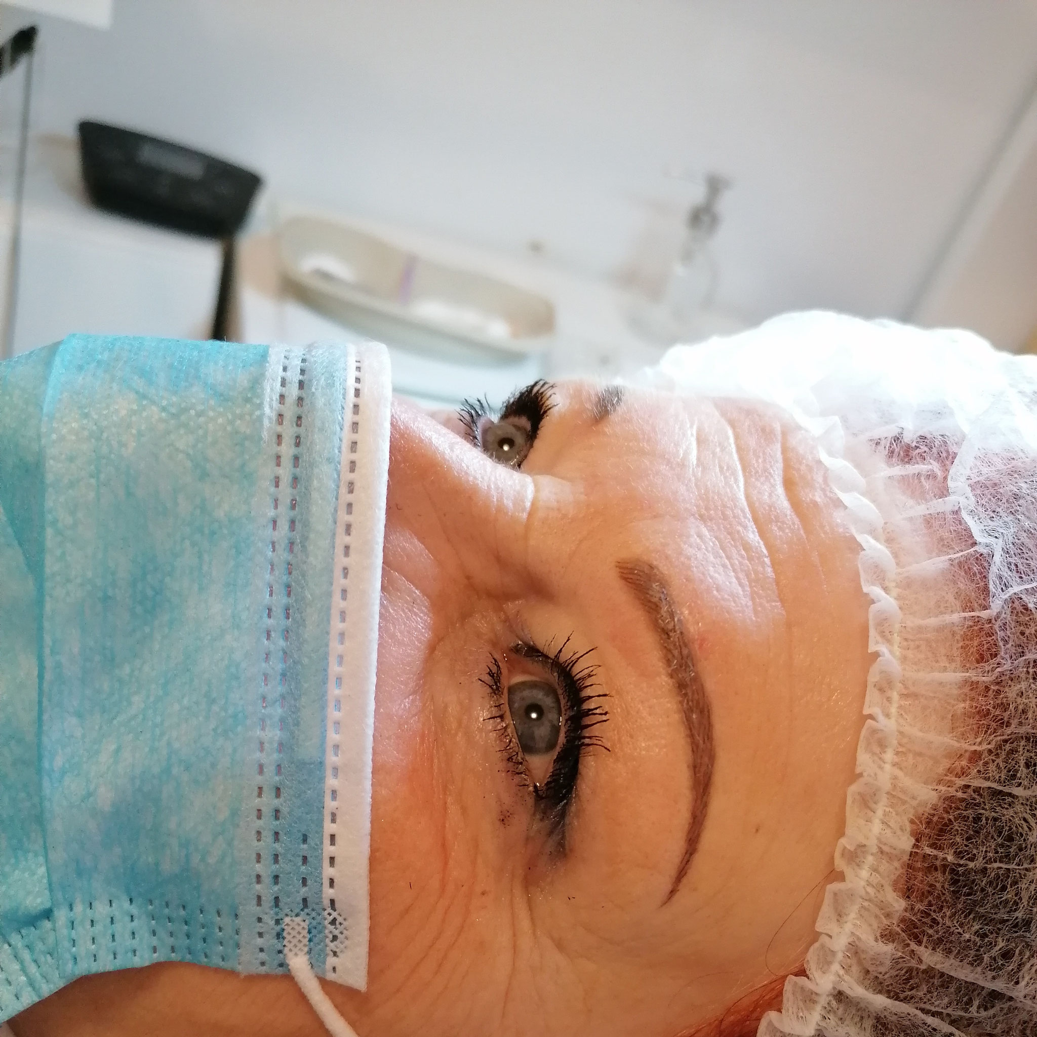 Wimpernkranz & feine Härchenpigmentierung
