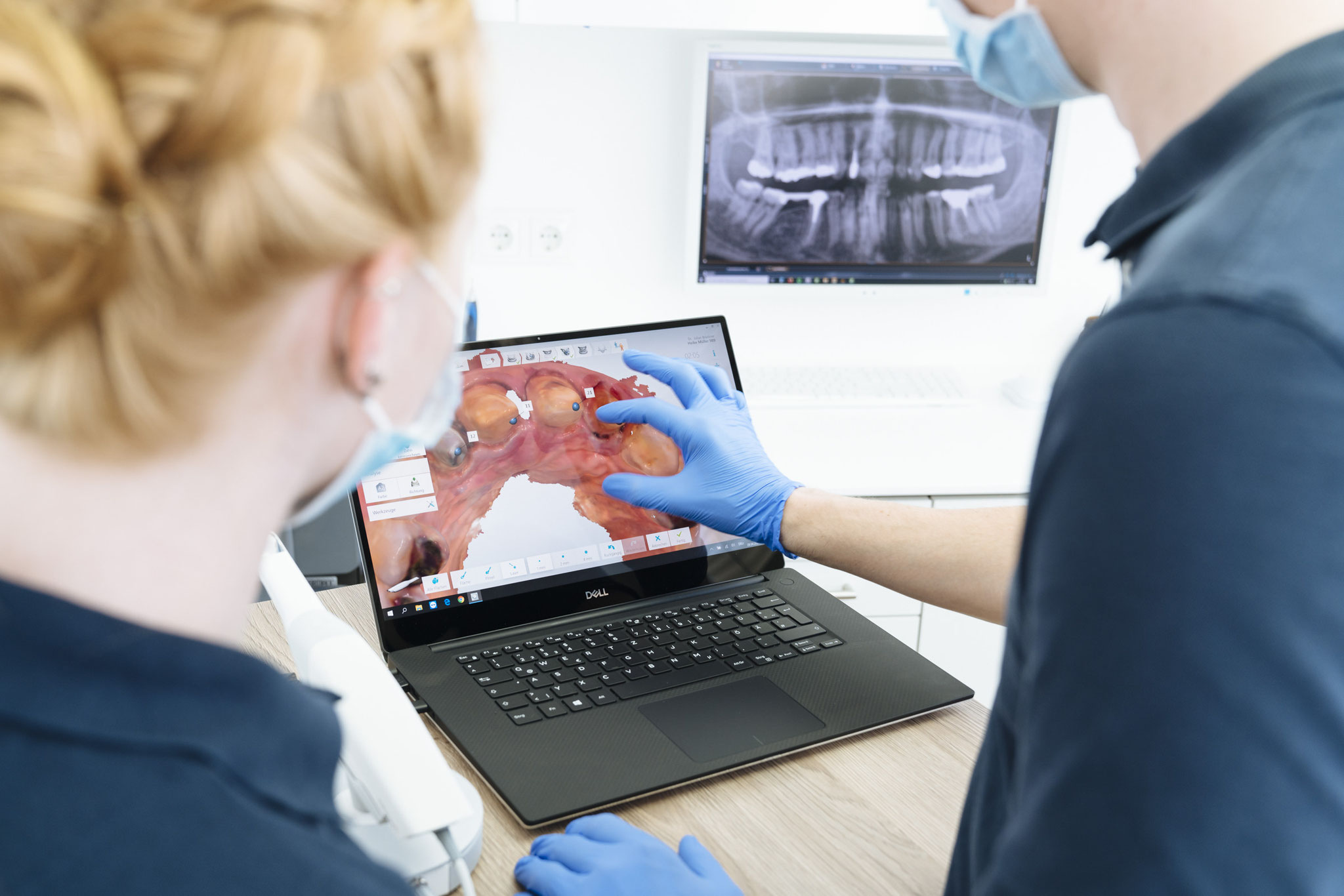 3D Intraoral Scanner und virtuelle Planungen